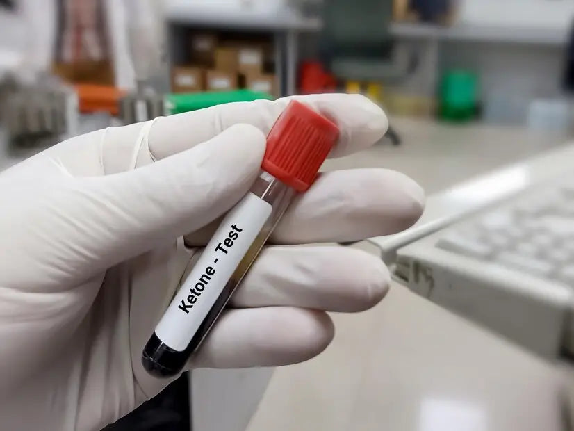 Diabetic Ketoacidosis: A Complete Guide For Individuals With Diabetes Obraz