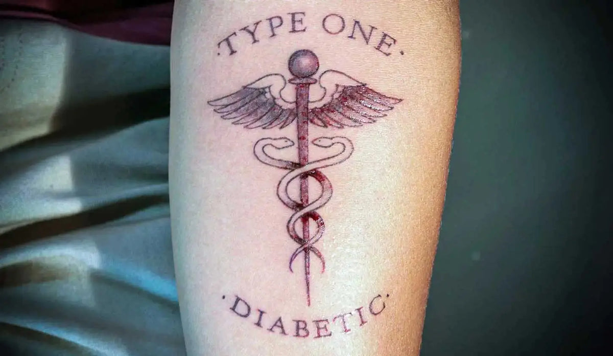 type 1 diabetic with a tattoo on the forearm  Obraz